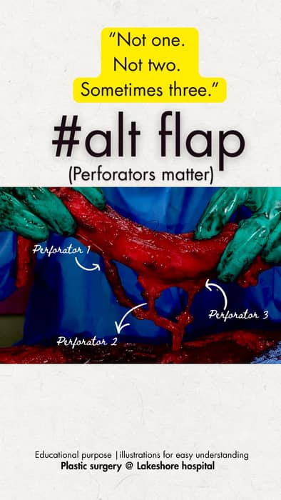 ALT flap perforator anatomy