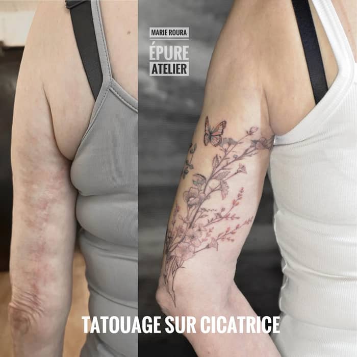 Double tatouage thérapeutique sur cicatrices pour Martine. Brachioplastie cachée sous les fleurs et 