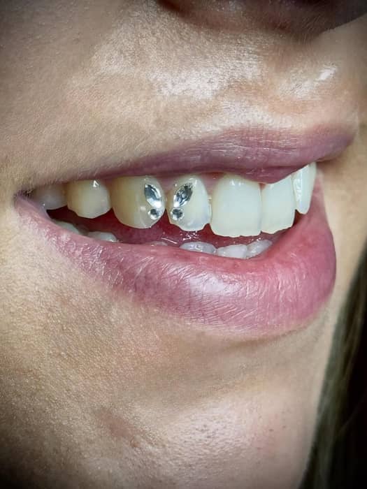 Gema dental de cristales Swarovski 💎
Adhesión segura, sin dañar el esmalte y con garantía profesional✨