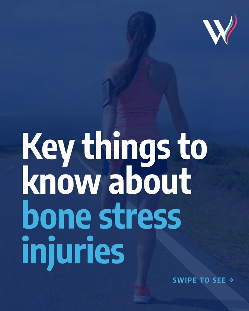 Bone stress injuries (BSIs) occur when repetitive loading on a bone exceeds its ability to repair itself. BSIs exist on a continuum of severity and a BSI may b…