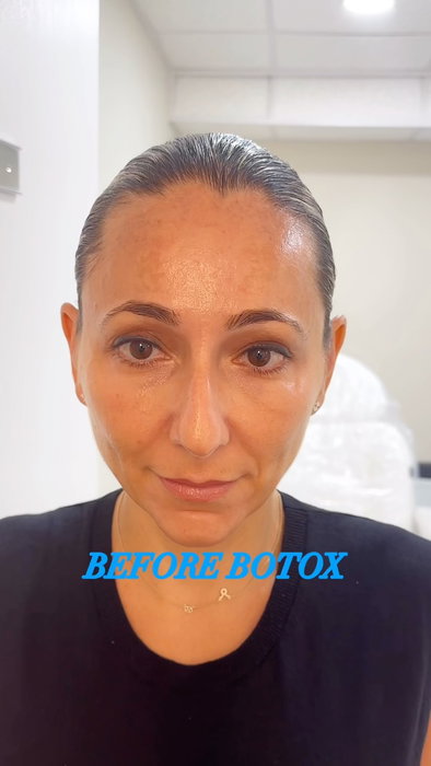 Proof that consistency changes everything. ✨. When done right, Botox treatment shouldn’t change how you look. It should 