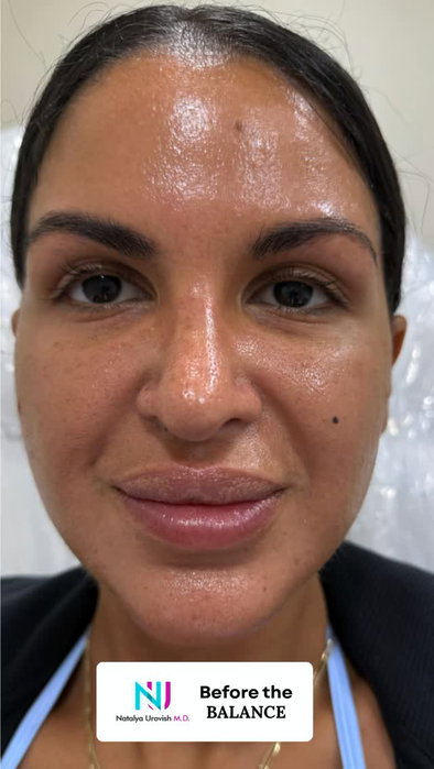 Plump lips + a sharp jawline = the ultimate duo. We are moments away from creating a perfectly balanced profile for this