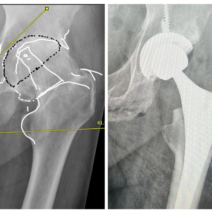 Últimos meses bien movidos en la clínica @redsaludcchc y @hospitalelcarmen
Casos diferentes y de todo un poco antes de u