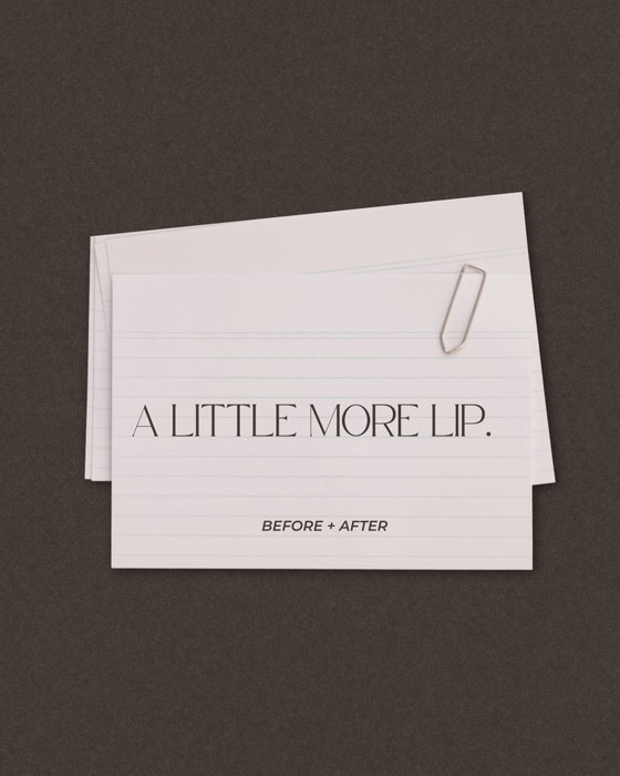 Fun fact 💋
Lip filler can refine the shape of your lips without dramatically increasing their size.
Strategic placemen