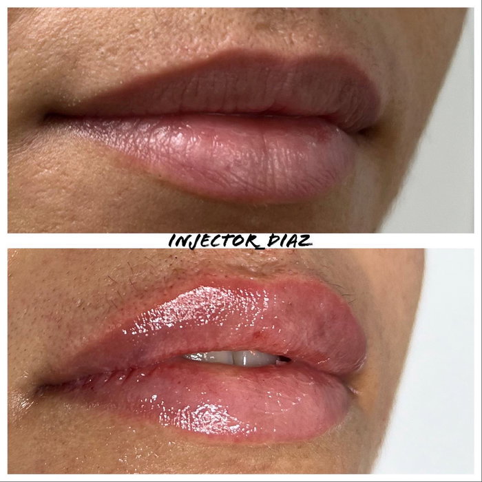 Got lips ? 👄