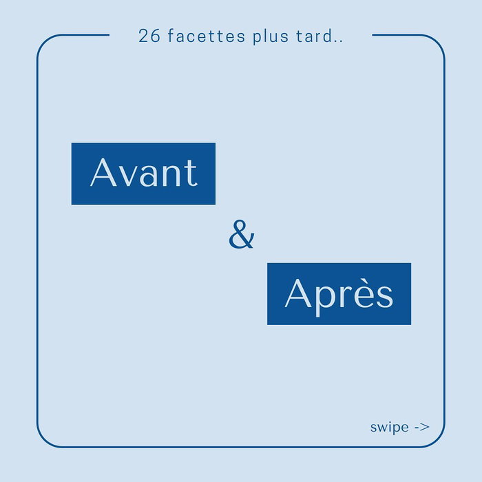 Là je vous partage ma préférée ! Il avait aussi 25 ans à la réalisation de ce soin et j’imagine pas à quel point on doit retrouver le sourir (image 1 sur 3)