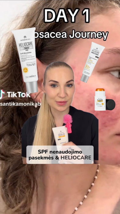 Šiais laikais tapo normalu viską vadinti „genetika“ arba „natūraliu senėjimu“. T