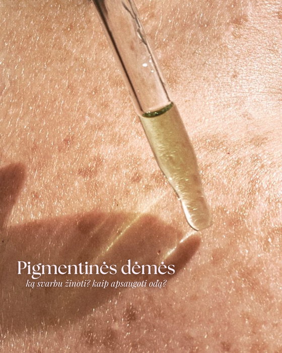 Pigmentinės dėmės dažniausiai atsiranda dėl UV spindulių poveikio, hormonų pokyč