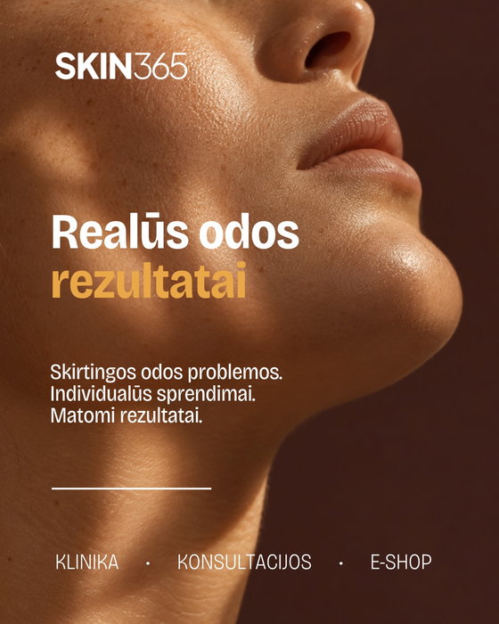 Rezultatai prasideda tada, kai nustojame spėlioti, ko reikia odai🧡
Tikslingai p
