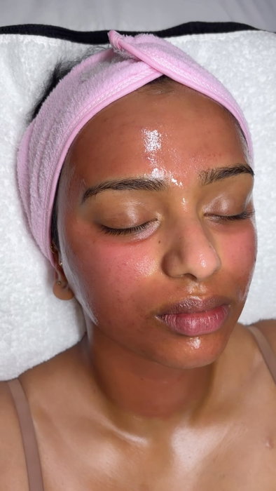 Microneedling helps boost collagen, smooth texture, soften fine lines, acne scars, tighten the skin, and gives you that fresh, plump glow. 💉💖

Basically… your skin’s little reset button. 🔄✨