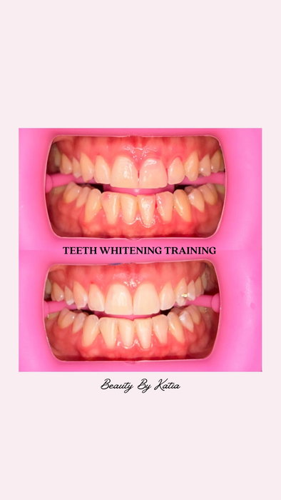 I started my beauty business with teeth whitening, and it grew into a six-figure business in under a year. ✨

Low startup costs, high profit potential. 💖

DM me to learn how you can get started! 🥰 -Keep in mind these results were achieved after just 20 minutes of whitening! ✨ The longer the whitening gel and LED light remain on the teeth, the brighter the results can be. 🦷🤍