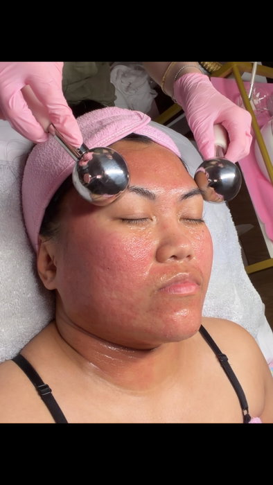 POV: The ice globes are your reward after microneedling. 🏆
