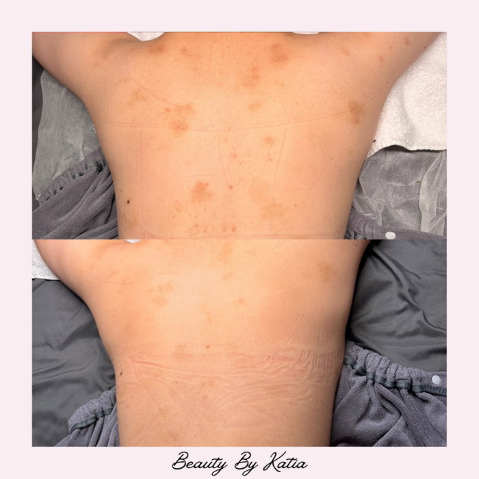 The fact that this is after just ONE Zena Algae Peel?! 🤯✨