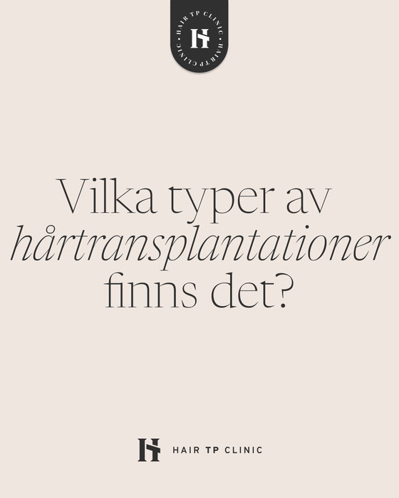 Det finns två typer av hårtransplantationer: FUE & DHI! ✌️ DHI-metoden är en gre…