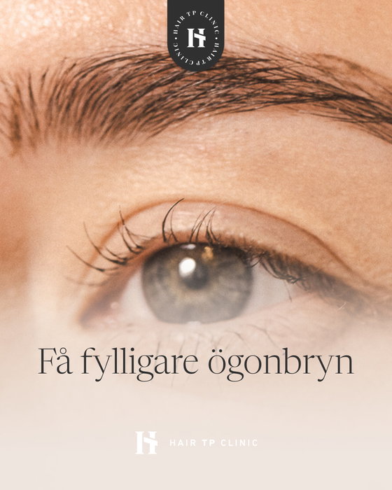 De flesta av våra kunder gör en ögonbrynstransplantation för att få fylligare ög…