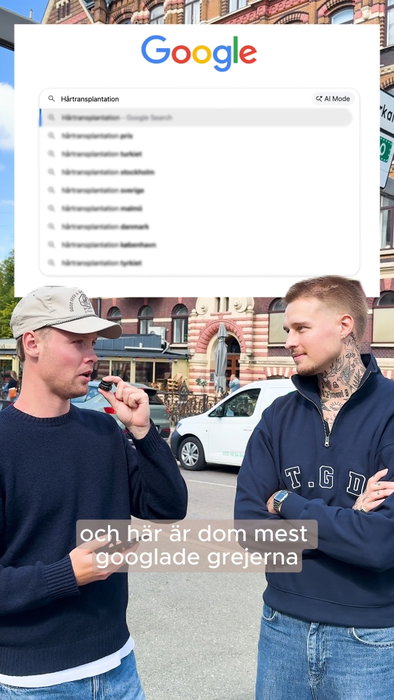 Kalle svarar på de mest googlade frågorna kring hårtransplantationer.