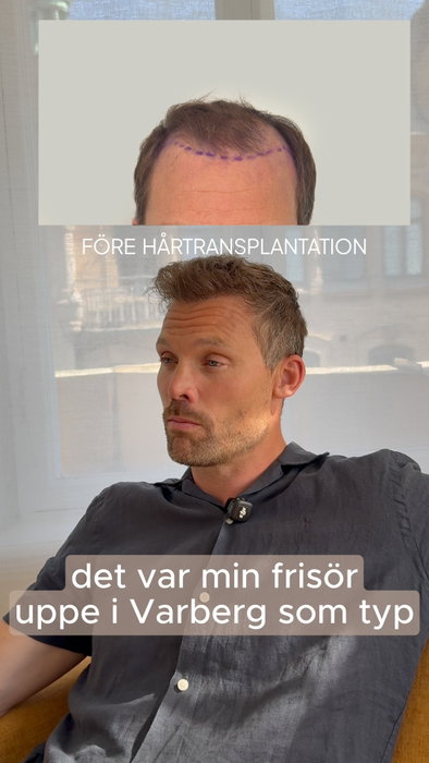 En av våra kunder, berättar varför han valde oss och hur hans resa började. Är d…