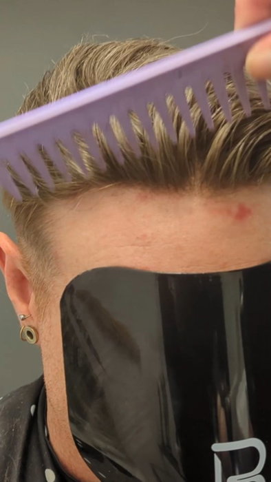Tired of Hair Loss? We Can Help You! Email: info@hair4alluk.com
Website: hair4alluk.com
Phone: 0117 454 5455