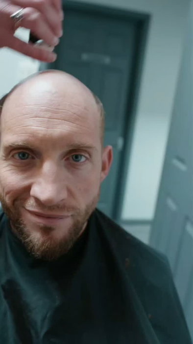 🫣 BALDING? WATCH THIS THIS!